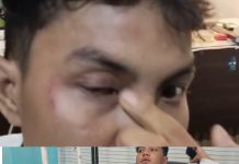 Anak HMI Kisaran Disiksa Dua Dept Kollector Yang Mengaku Suruhan Karyawan SMS Finance
